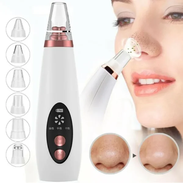 Rechargeable Electric Blackhead Remover - Image 3